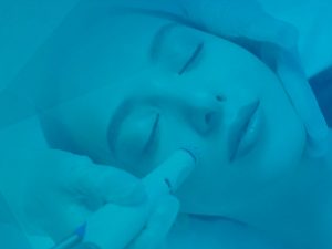 Radiofrecuencia facial y corporal Granada