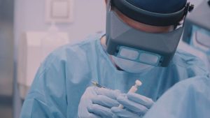 Microinjerto capilar técnica FUE en Andalucía - Jerez