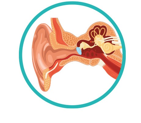 Enfermedad de Ménière